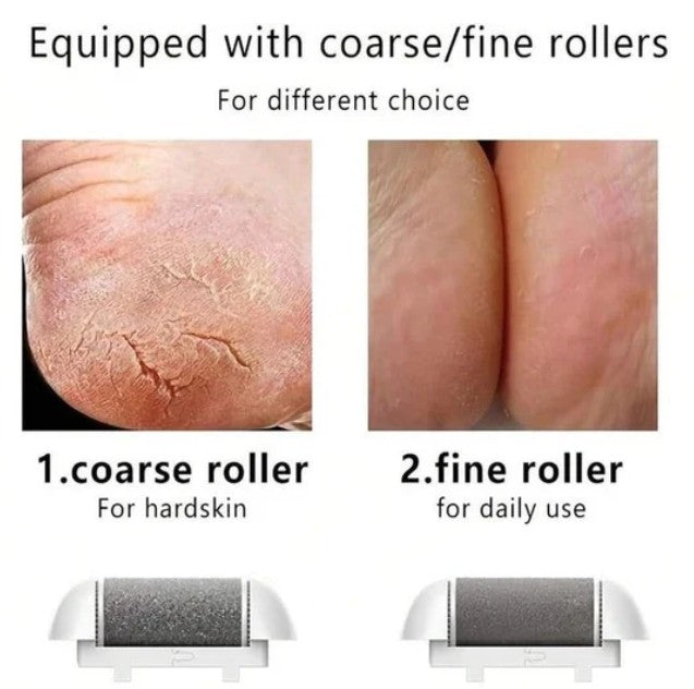 VelvetTouch - Flawless Pedi Cordless Electronic Callus & Skin Smoother by Lunovia Life
