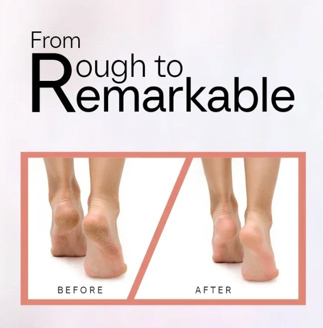 VelvetTouch - Flawless Pedi Cordless Electronic Callus & Skin Smoother by Lunovia Life