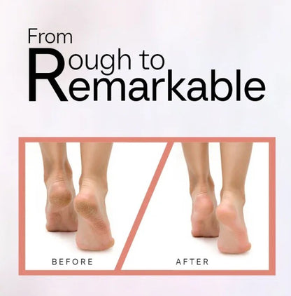 VelvetTouch - Flawless Pedi Cordless Electronic Callus & Skin Smoother by Lunovia Life